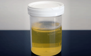 Urine Tests have been around since 6,000BC